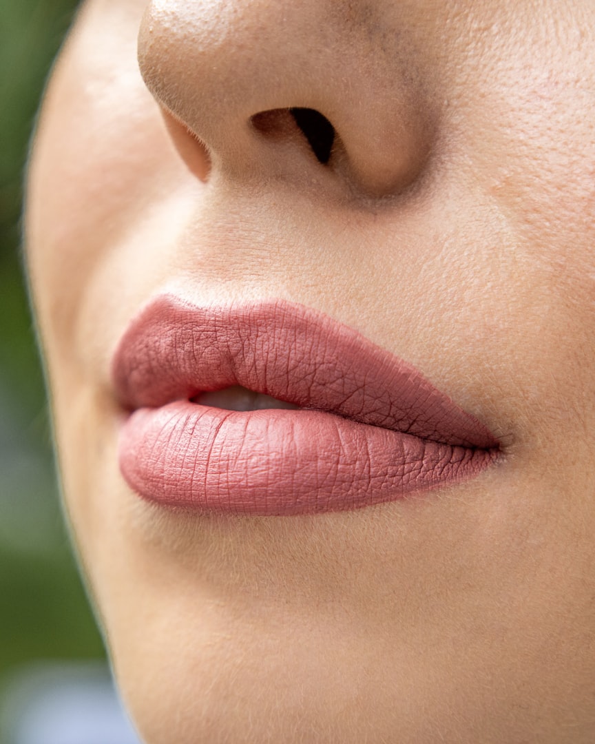 lip fillers botox